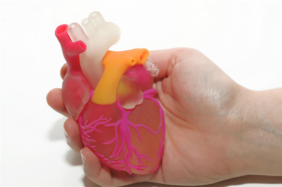 3D-printed organs: ongoing